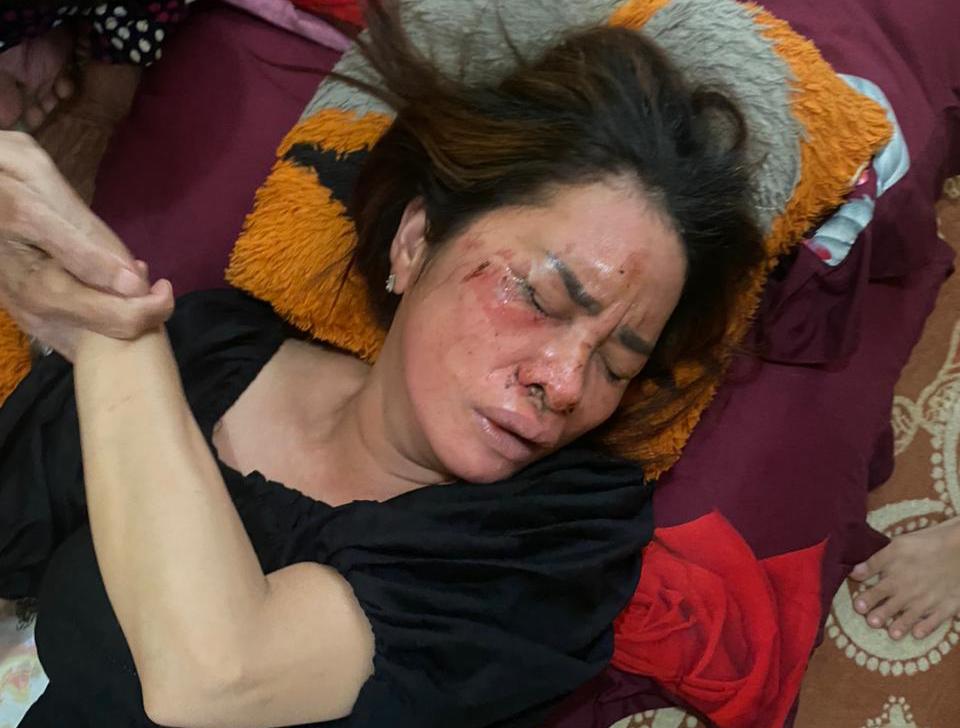 Karena Penanganan Kasus Penganiayaan Siti Norrahmah Belum Jelas, Kuasa Hukum Korban Bersurat ke Polda Kalsel